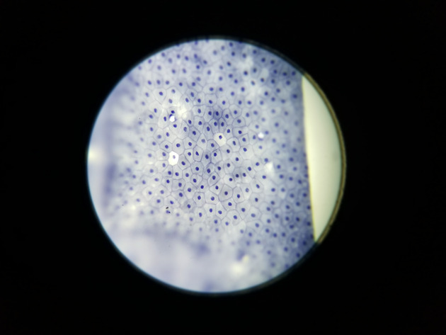 Simple Squamous Epithelium Slides - Simple Squamous Epithelium 02 100X